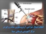  آرتروسکوپی شانه و زانو